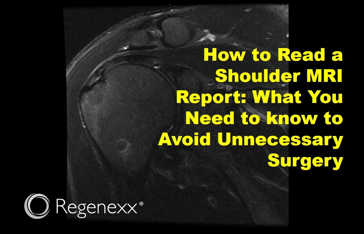 Normal Vs Abnormal Shoulder Mri: Key Differences Explained